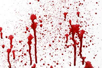 Blutbad am Bondmarkt?